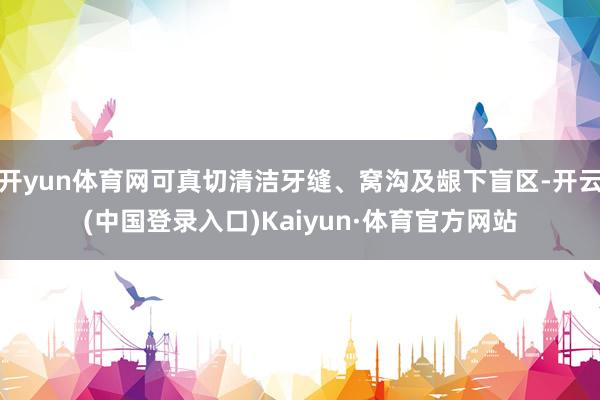 开yun体育网可真切清洁牙缝、窝沟及龈下盲区-开云(中国登录入口)Kaiyun·体育官方网站